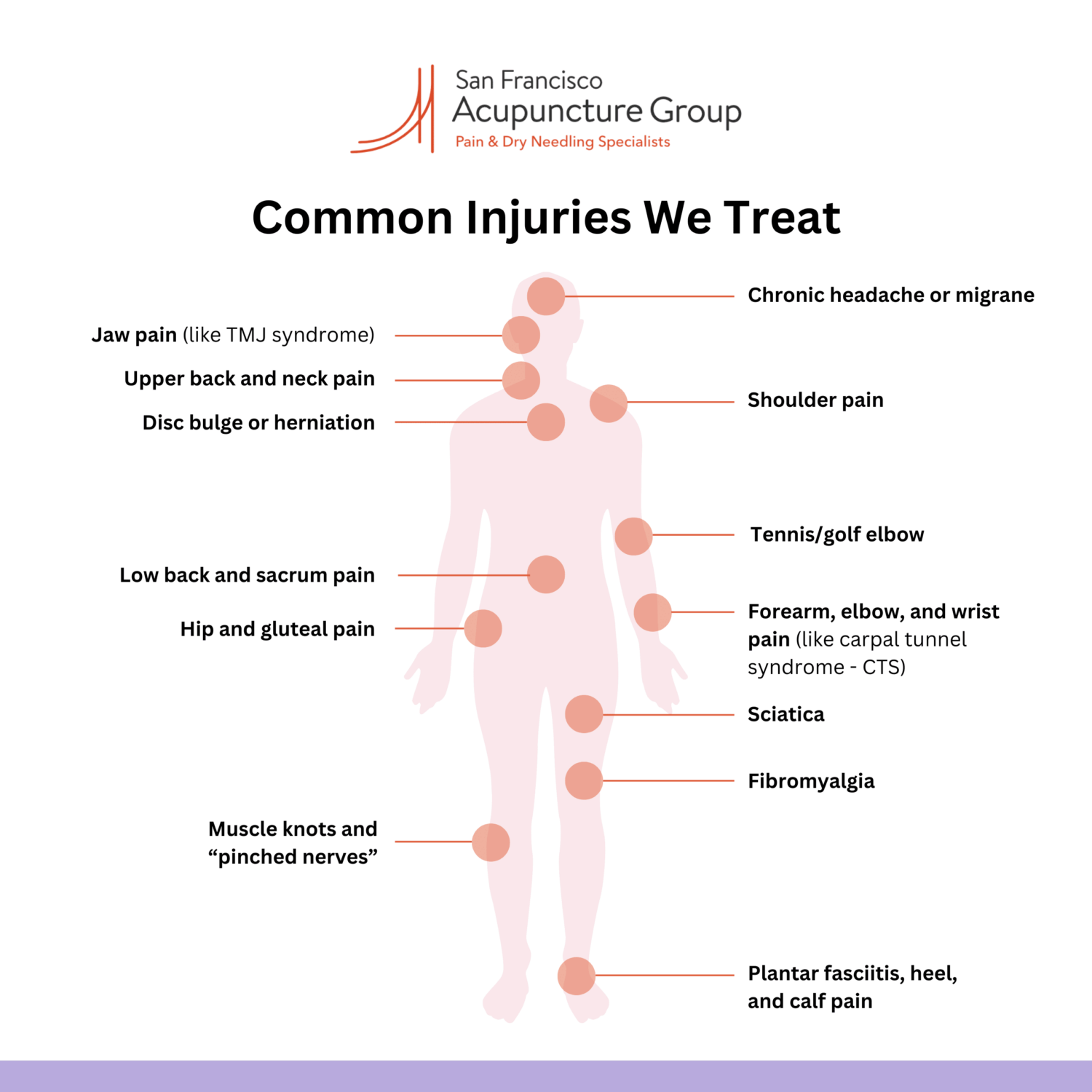 Infographic illustrating common injuries we treat: Muscle knots and “pinched nerves”, Upper back and neck pain, Jaw pain (like TMJ syndrome), Shoulder pain, Low back and sacrum pain, Disc bulge or herniation, Hip and gluteal pain, Forearm, elbow, and wrist pain (like carpal tunnel syndrome — CTS), Tennis/golf elbow, Plantar fasciitis, heel, and calf pain, Sciatica, Chronic headache or migraine, Fibromyalgia